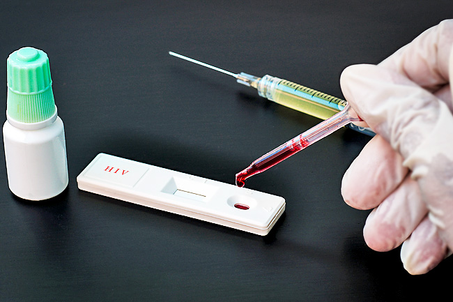 How To Prepare For An HIV Test In Malaysia