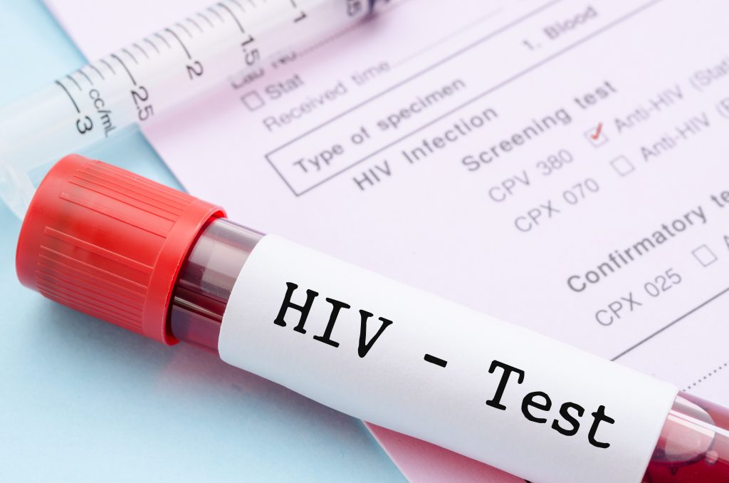 hiv test malaysia